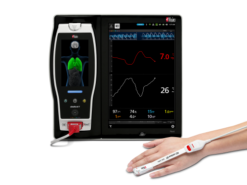 Masimo Patient SafetyNet<sup>™</sup> with Root<sup>®</sup> and Replica<sup>™</sup>