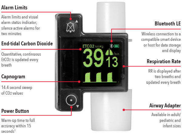 Masimo - Radius PCG Features Diagram