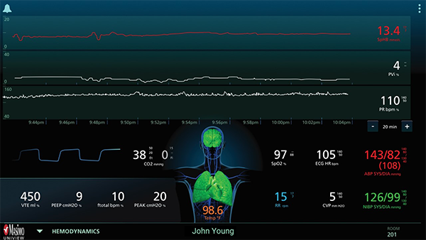 Masimo - UniView - Hemodynamics Layout