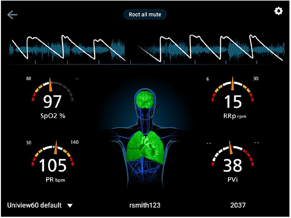 User interface measurement screen of Uniview