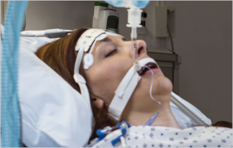 Sleeping patient intubated in hospital bed being monitored with Masimo sensor.